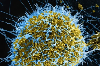 Ebola: SUA introduc o nouă obligaţie de călătorie pentru toţi pasagerii zborurilor internaţionale, inclusiv pentru cei care pleacă din România